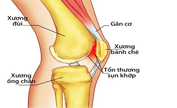 Cấu tạo khớp gối