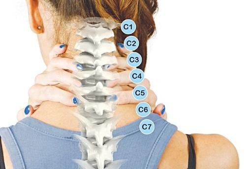 Dấu hiệu Thoái hóa cột sống cổ