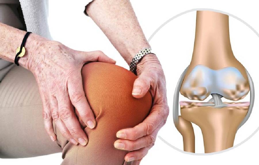 Dấu hiệu Thoái hóa khớp gối