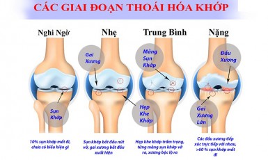 thoái hoá khớp gối