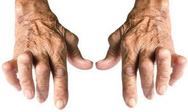 Viêm khớp dạng thấp là gì