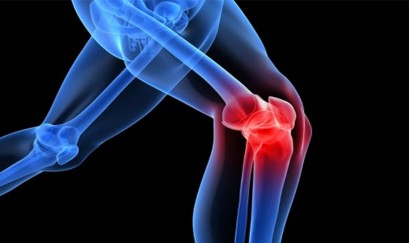 Dấu hiệu Thoái hóa khớp gối