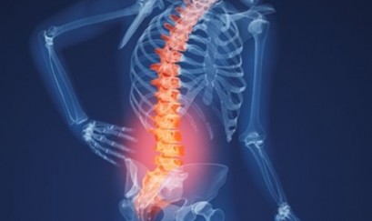 Dấu hiệu nhận biết thoái hoá cột sống thắt lưng