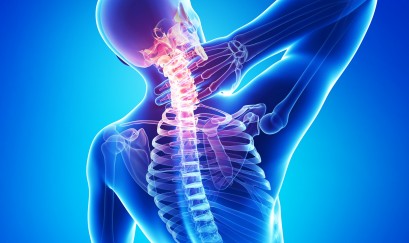 Dấu hiệu Thoái hóa cột sống cổ